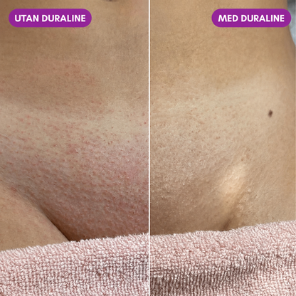 DURALINE – Din genväg till hårfri hud.